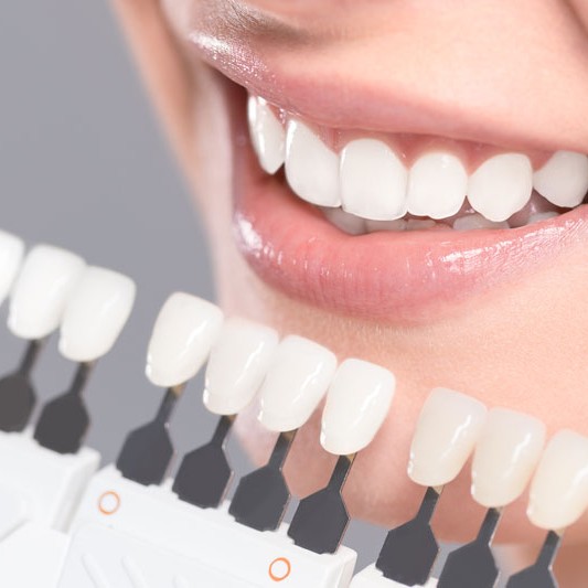 Oralduero clínica dental en Aranda de Duero tratamientos estética dental carillas