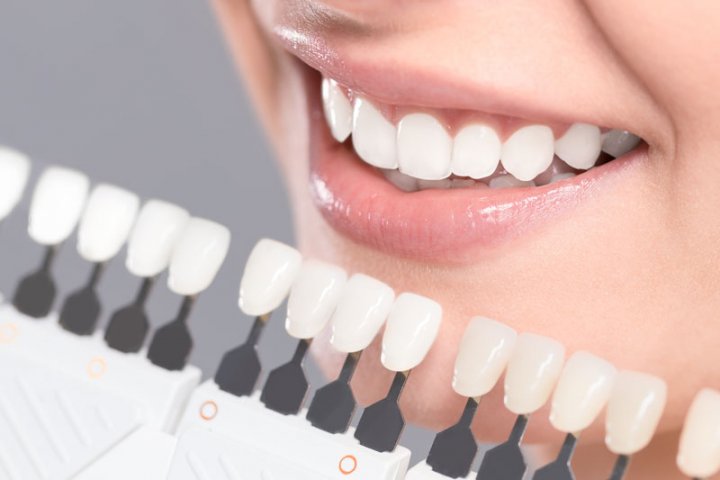 Oralduero clínica dental en Aranda de Duero tratamientos estética dental carillas