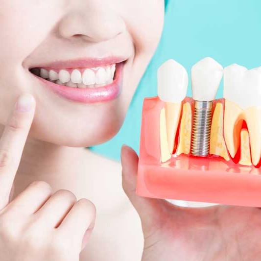 Oralduero clínica dental en Aranda de Duero tratamientos implantes