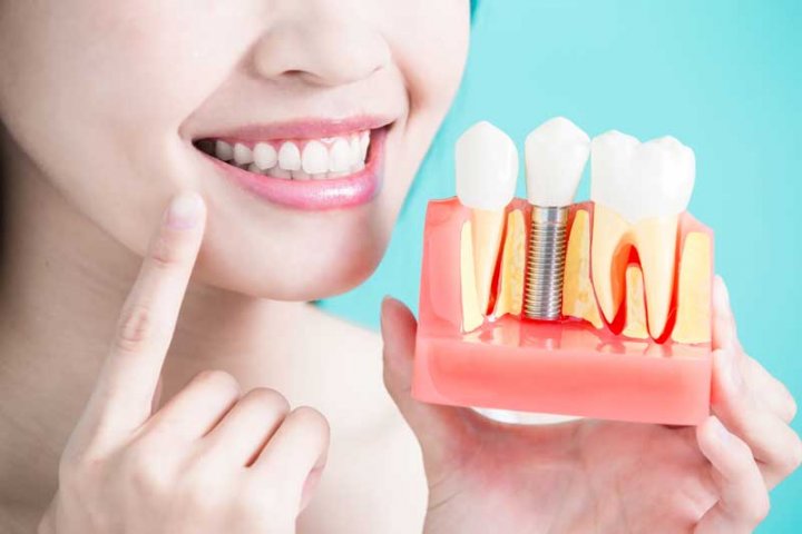 Oralduero clínica dental en Aranda de Duero tratamientos implantes