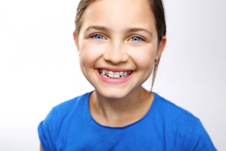 Oralduero clínica dental en Aranda de Duero tratamientos ortodoncia infantil