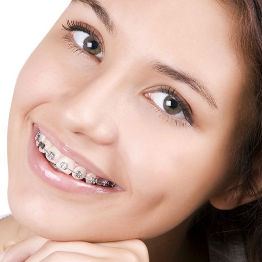 Oralduero clínica dental en Aranda de Duero tratamientos ortodoncia brackets