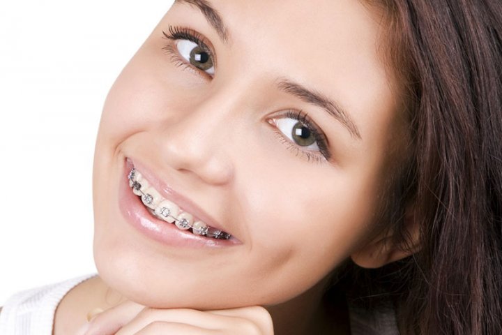 Oralduero clínica dental en Aranda de Duero tratamientos ortodoncia brackets