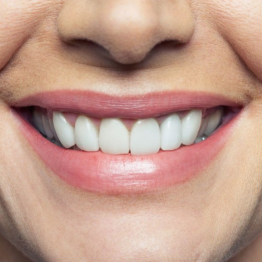 Oralduero clínica dental en Aranda de Duero tratamientos periodoncia
