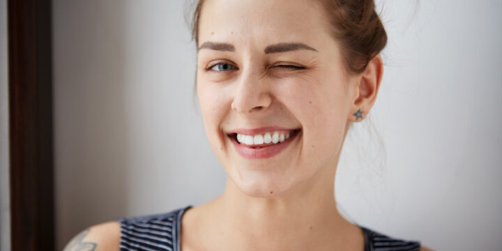 estética dental natural